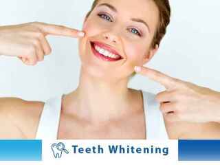 teeth-whitening-armadale-wa-6112-armadale-dental-centre