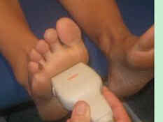 surgeries-to-fix-flat-feet-south-amboy