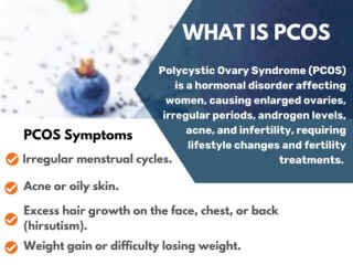 polycystic-ovarian-syndrome-treatment-in-usa